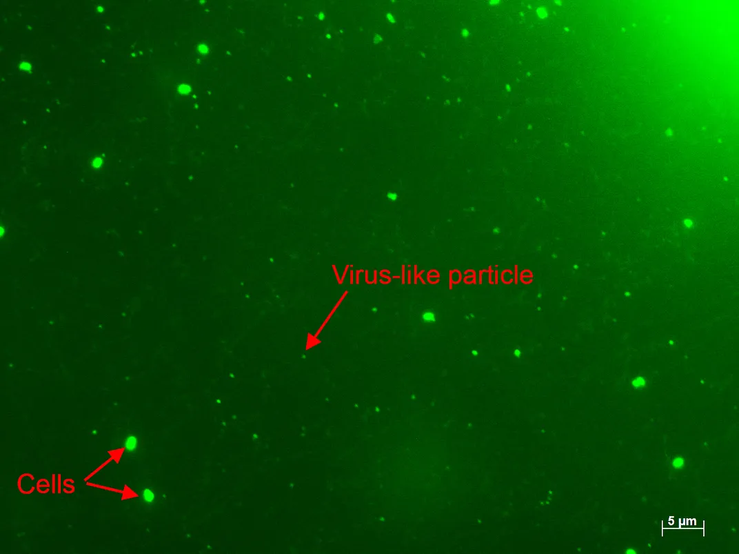 green dots under microscope, one marked as virus-like particle and two marked as cells